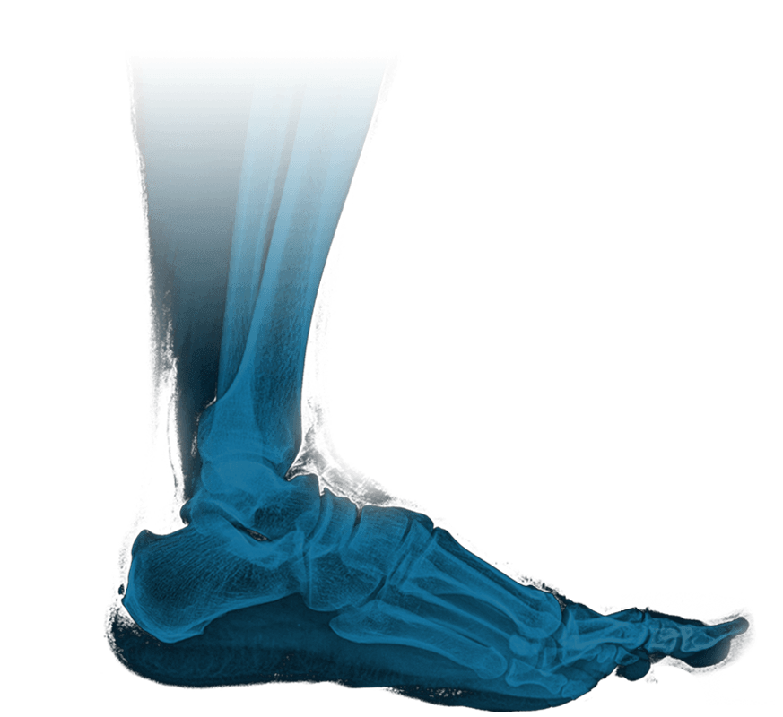 Footwear